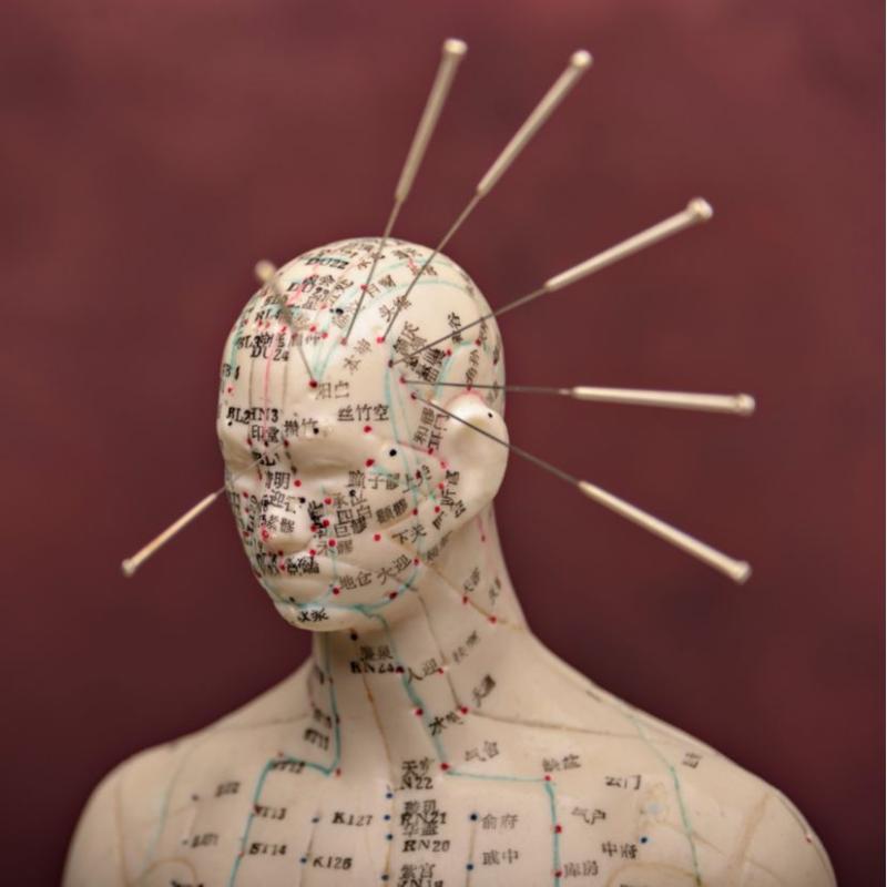 Acupuntor