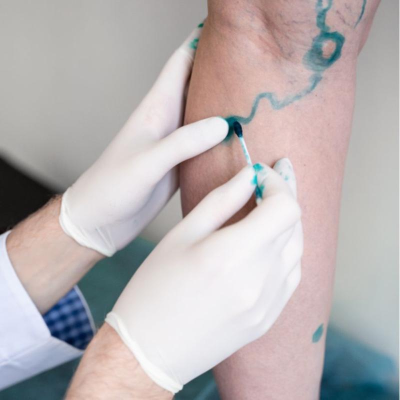 Cirujano Vascular