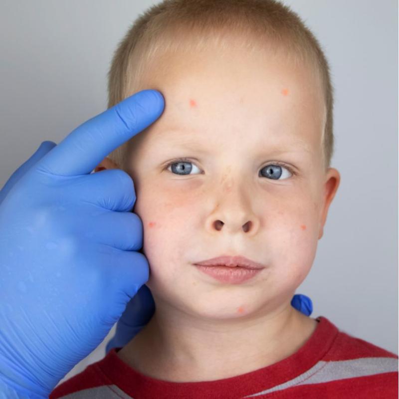 Dermatólogo Pediatra