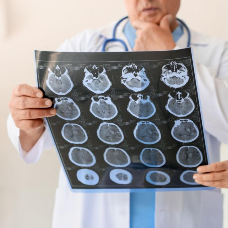 Neurólogo Pediatra